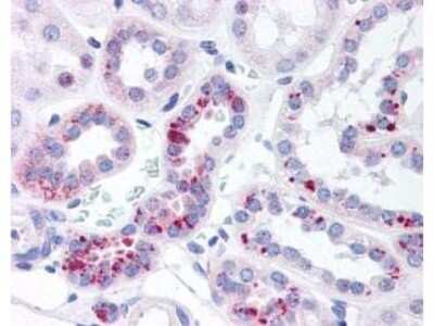 Immunohistochemistry: STAT5A [p Tyr694] Antibody [NBP1-77851]